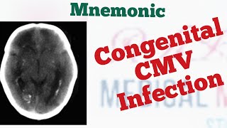 Congenital CytomegalovirusCMV triad Mnemonic [upl. by Rebane]