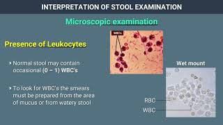 Interpretation of Stool Examination [upl. by Nitsa]