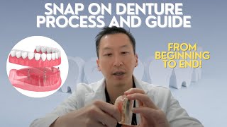 Snap on denture steps [upl. by Tempest]