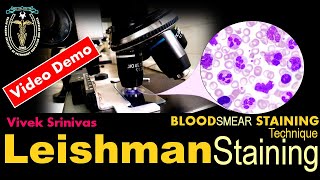 LEISHMAN STAINING  Blood Smear Staining Technique  Microbiology  Vivek Srinivas  Bacteriology [upl. by Glick506]