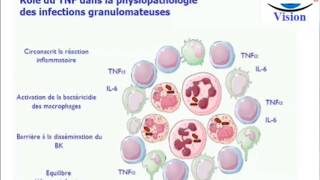 Physiopathologie et Traitement du Psoriasis Biothérapie Spondylarthropathies [upl. by Ahterahs894]