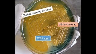 TCBS agar with Vibrio cholerae showing yellow colonies [upl. by Ellehcsar70]