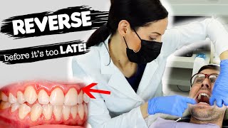 How To Treat Gum Disease [upl. by Malony325]