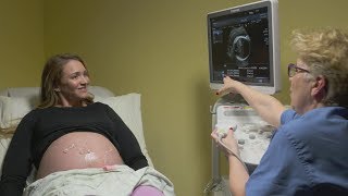 Ultrasounds during pregnancy [upl. by Yuria547]