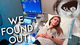 12 WEEK ULTRASOUND RESULTS  PREGNANCY VLOG [upl. by Lebasile]