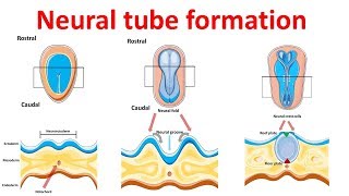 neural tube formation  Embryology  Neurulation [upl. by Reisch]