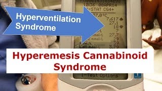 Cannabinoid Hyperemesis A Case Series of 98 Patients [upl. by Aileen935]