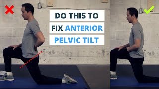 6 Minute Routine to Correct ANTERIOR Pelvic Tilt [upl. by Rodger]