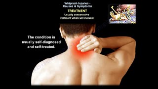 Whiplash Injuries Causes amp Symptoms  Everything You Need To Know  Dr Nabil Ebraheim [upl. by Ossie]