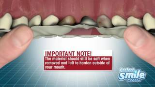 Perfect Smile Veneers Instructional  Getting Started [upl. by Nennarb]