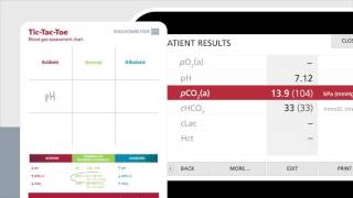 Reading the blood gas report using TicTacToe – Radiometer [upl. by Bowne]