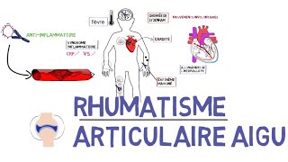 Rhumatisme articulaire aigu RAAde A à Z [upl. by Etnoek]