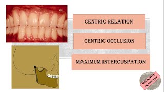 Centric Relation  Centric Occlusion  Maximum Intercuspation [upl. by Nazus]