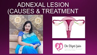 ADNEXAL LESION CAUSES amp TREATMENT [upl. by Iives]