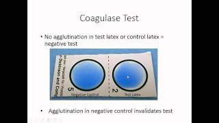 Identification of Staphylococcus [upl. by Anitan]