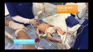 REANIMACION NEONATAL ALGORITMO COMPLETO [upl. by Gilbye]