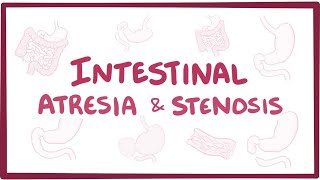 Intestinal atresia amp stenosis  an Osmosis Preview [upl. by Tallula]