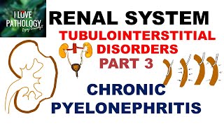 CHRONIC PYELONEPHRITIS  PATHOLOGY [upl. by Ennalorac]