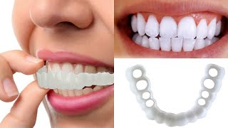 magic smart smile veneers [upl. by Nelon611]