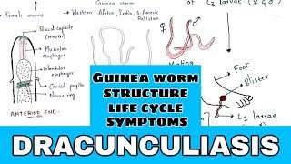 Dracunculiasis  Guinea worm  Structure Life cycle symptoms treatment  Bio science [upl. by Annekam]