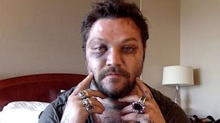 Bam Margera Shares Brutal Injury Photos After Attack by Icelandic Rappers [upl. by Nongim]