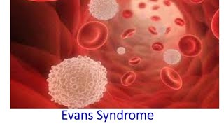 Evans syndromea rare blood disorder [upl. by Lanaj378]