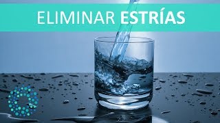 Cómo ELIMINAR ESTRÍAS con REMEDIOS CASEROS [upl. by Feirahs655]