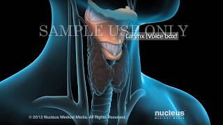 Robotic Thyroidectomy [upl. by Peadar70]