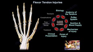 Flexor Tendon Injuries  Everything You Need To Know  Dr Nabil Ebraheim [upl. by Lesya]