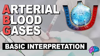 Basic ABG Interpretation  Arterial Blood Gases Part 3 [upl. by Liamsi]