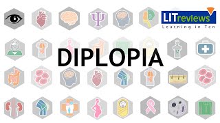 Diplopia [upl. by Bronson]