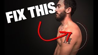 How to Fix Rounded Shoulders GONE IN 4 STEPS [upl. by Aizti]