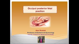 Occiput posterior fetal position [upl. by Bartholomeo661]