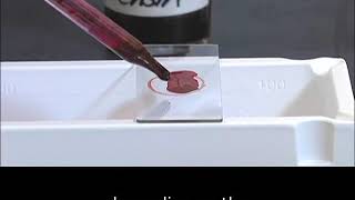 Staining technique in microbiology Acid fast staining [upl. by Williams]