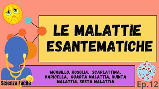 Le malattie esantematiche ep 12 [upl. by Barnett]